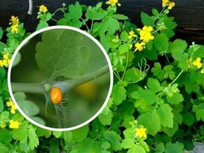 sok od biljke celandina za liječenje plantarnih bradavica